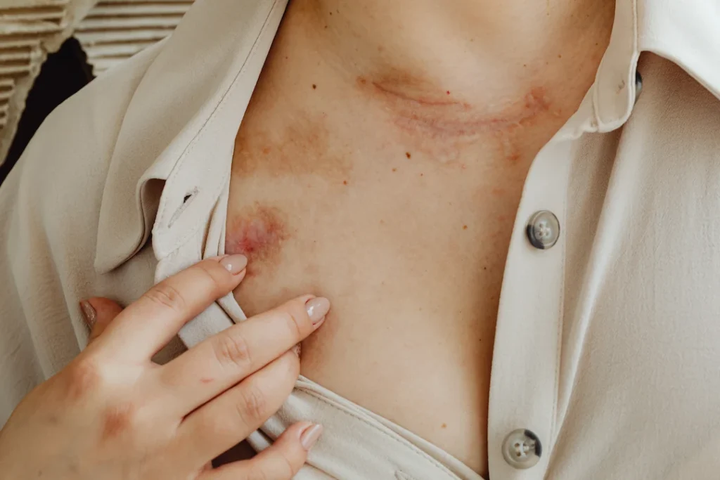 The Doyle Law Offices will guide you through the personal injury claim process in North Carolina. This depicts a woman with scars and bruises on her chest. 